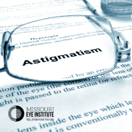 astigmatism
